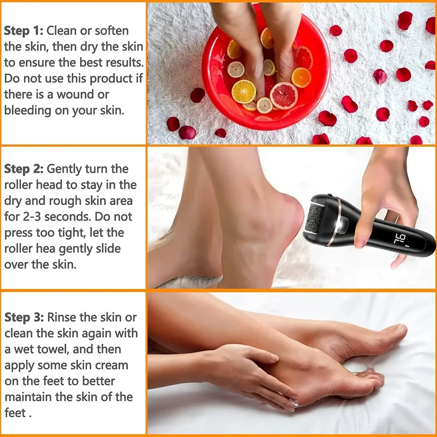 Rechargeable Electric Foot File Callus Remover Machine - Pedicure Device Foot Car, Remove Dead Hard Skin