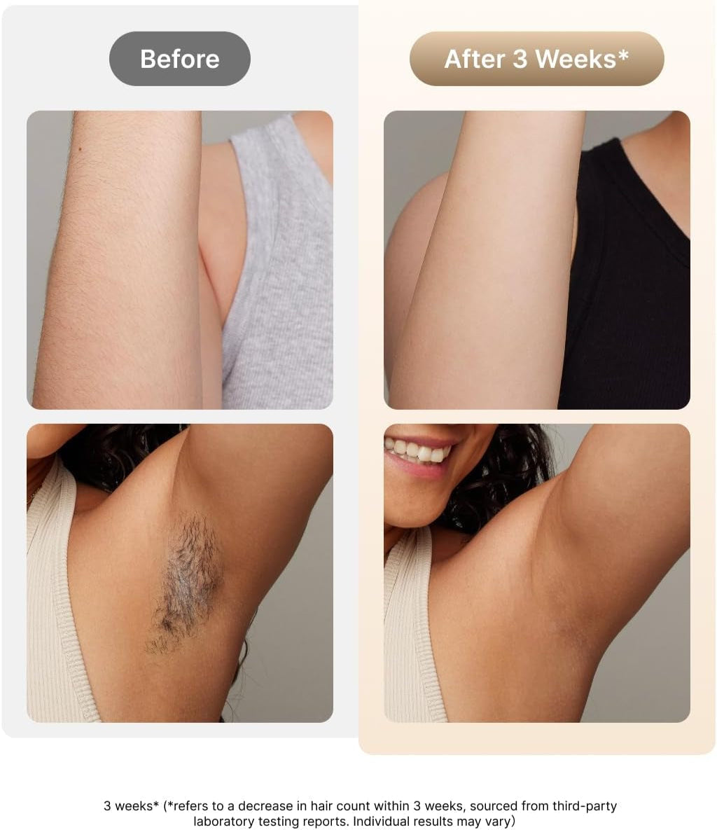  IPL Laser Hair Removal for Women, Men, IPL Hair Removal - Sapphire Ice-Cooling System, Painless & Long-Lasting Result, Flat-Head Design, Body & Face, White