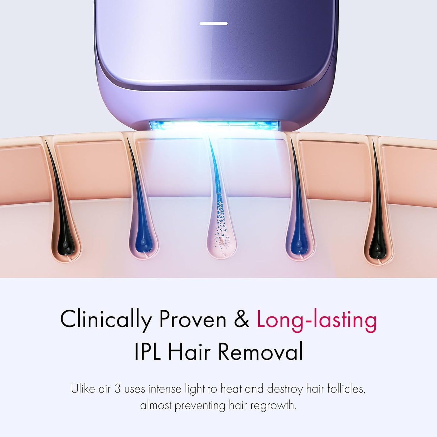  IPL Hair Removal Device with Ice-Cooling - Laser Hair Removal for Women and Men, Long-Lasting - Painless Treatment, For Facial, Bikini & Whole Body