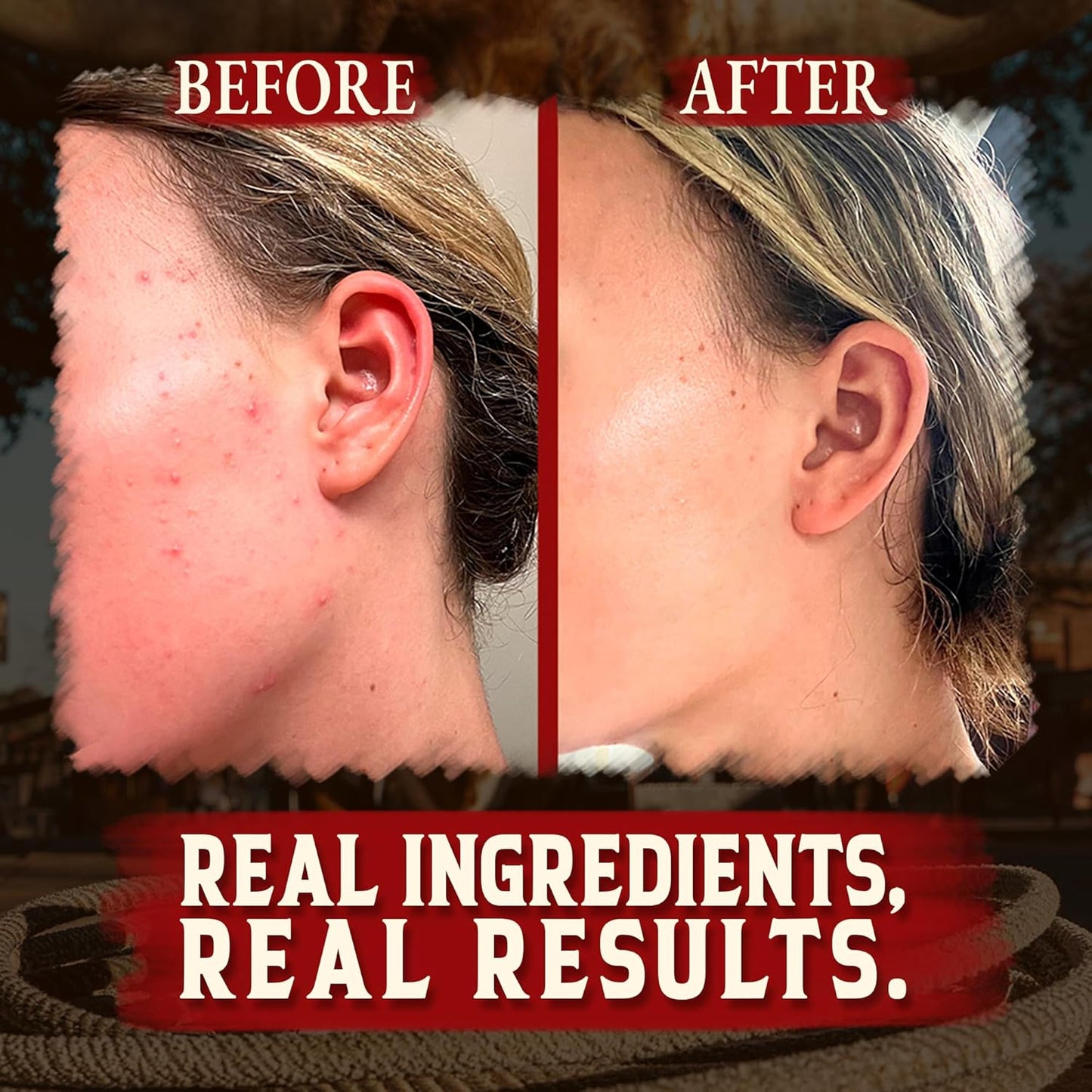 Organic Beef Tallow for Skin - 4 OZ (Unscented) — Grass Fed Beef Tallow for Face + Body — Us-Made Whipped Tallow and Honey Balm Moisturizer for Dry and Sensitive Skin, Eczema, Rosacea (No Additives)