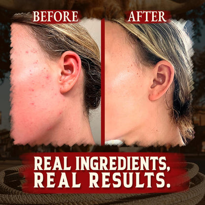 Organic Beef Tallow for Skin - 4 OZ (Unscented) — Grass Fed Beef Tallow for Face + Body — Us-Made Whipped Tallow and Honey Balm Moisturizer for Dry and Sensitive Skin, Eczema, Rosacea (No Additives)