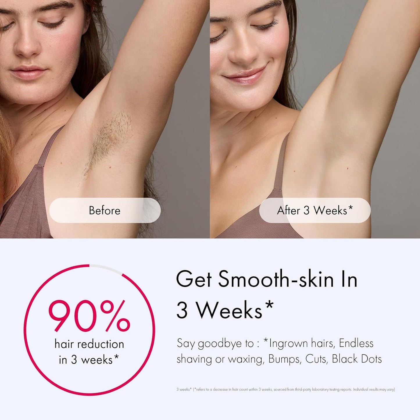  IPL Hair Removal Device with Ice-Cooling - Laser Hair Removal for Women and Men, Long-Lasting - Painless Treatment, For Facial, Bikini & Whole Body