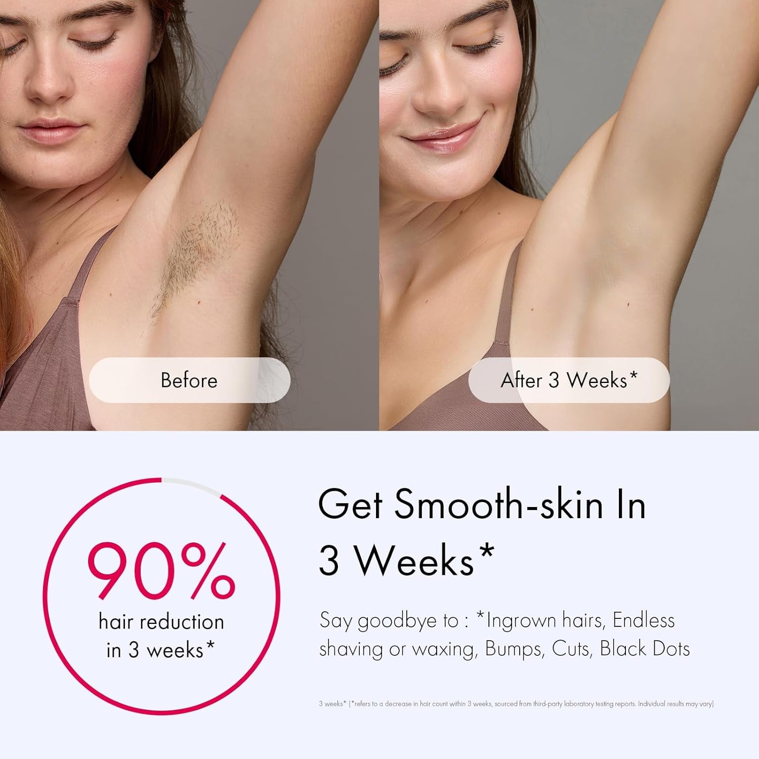  IPL Hair Removal Device with Ice-Cooling - Laser Hair Removal for Women and Men, Long-Lasting - Painless Treatment, For Facial, Bikini & Whole Body