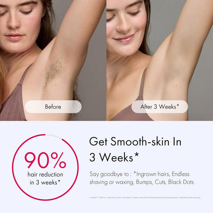  IPL Hair Removal Device with Ice-Cooling - Laser Hair Removal for Women and Men, Long-Lasting - Painless Treatment, For Facial, Bikini & Whole Body