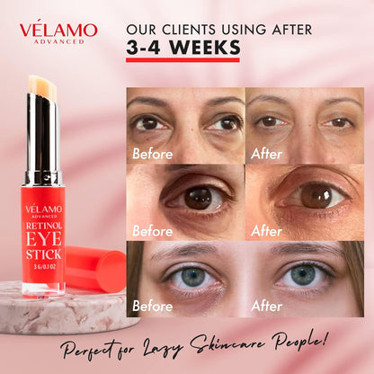 Retinol Eye Stick: Renewing & Firming under Eye Balm for Dark Circles, Puffiness, Fine Lines & Wrinkles - Travel Essentials, Portable & Perfect for On-The-Go Use, 0.1 Oz/3G