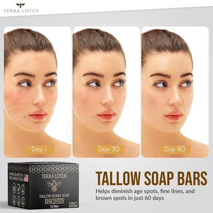 Organic Tallow Soap with Organic Castor Oil & Raw Honey - Relief for Dark Spots, Acne Marks, Hydrating & Nourishing - 3 Pack (Unscented)