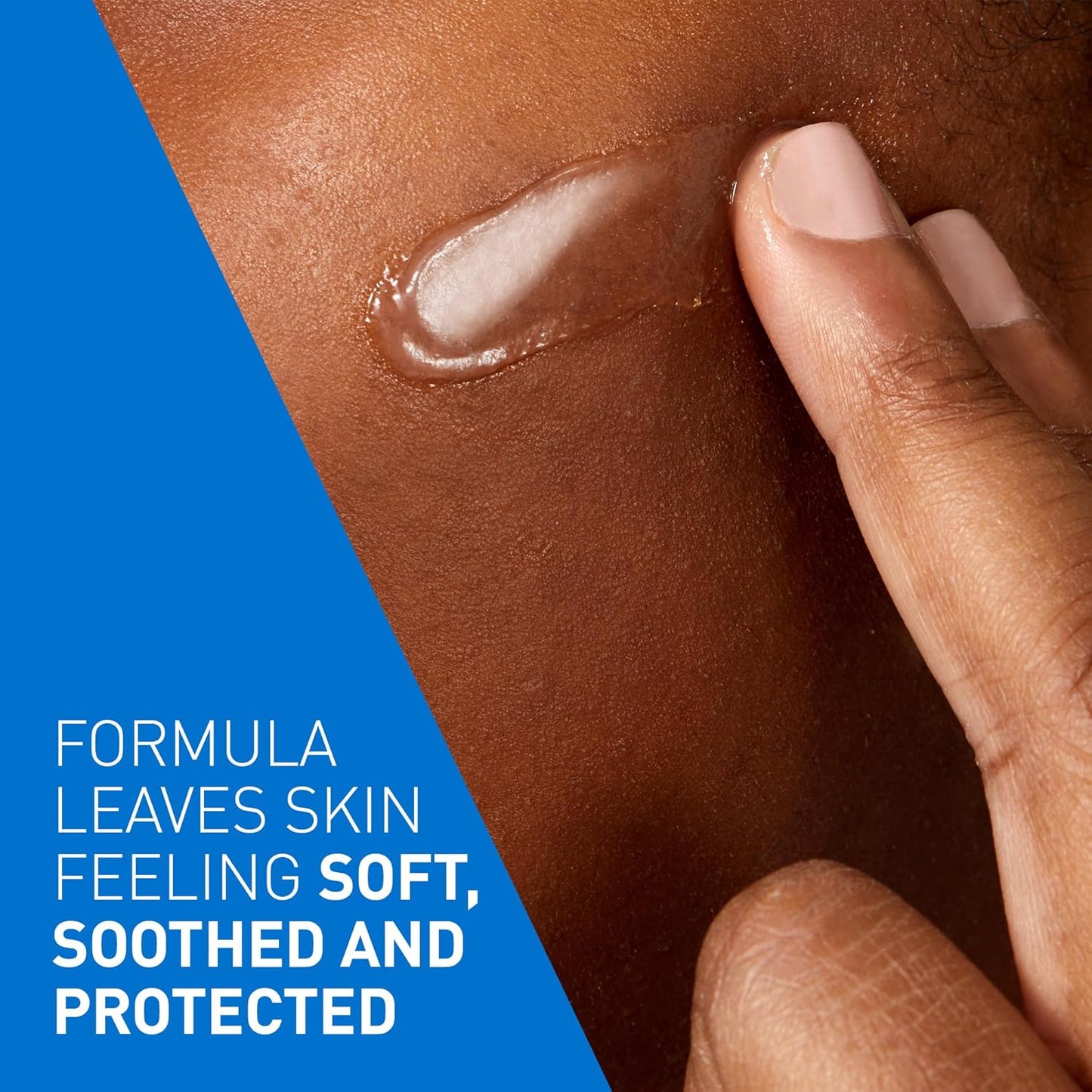 Healing Ointment, Moisturizing Petrolatum Skin Protectant for Dry Skin with Hyaluronic Acid and Ceramides, Multi-Purpose Face, Body & Lip Balm, Lanolin-Free & Fragrance-Free, 340G