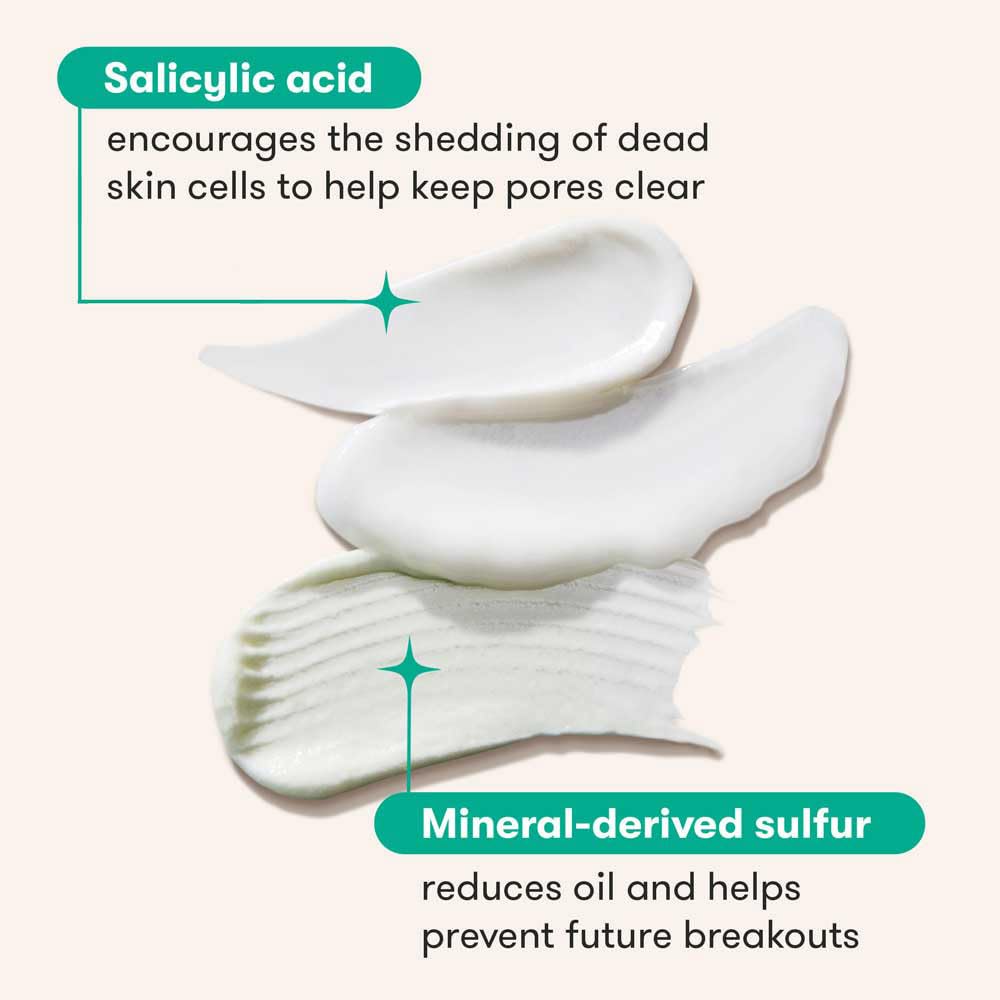 Salicylic Acid Face Wash, Benzoyl Peroxide Pore Minimizing Treatment-90 Day Complete Acne Skin Care Kit