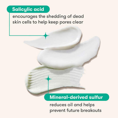 Clean 3 Step Acne Routine W/ Pimple Patches- 30 Day Acne Kit with Pimple Patches