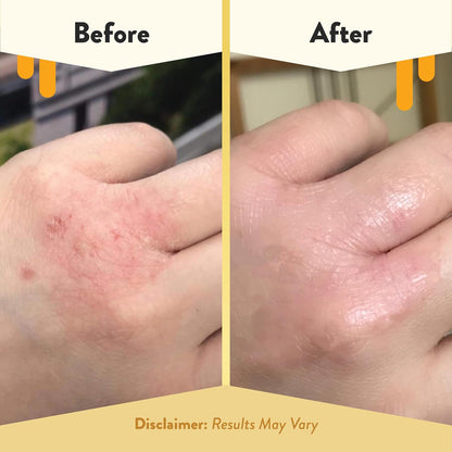 Original Skin-Soothing Cream - Organic Hand & Body Eczema Relief - Natural Honey Lotion for Dry, Itchy, & Irritable Skin (4 Oz)