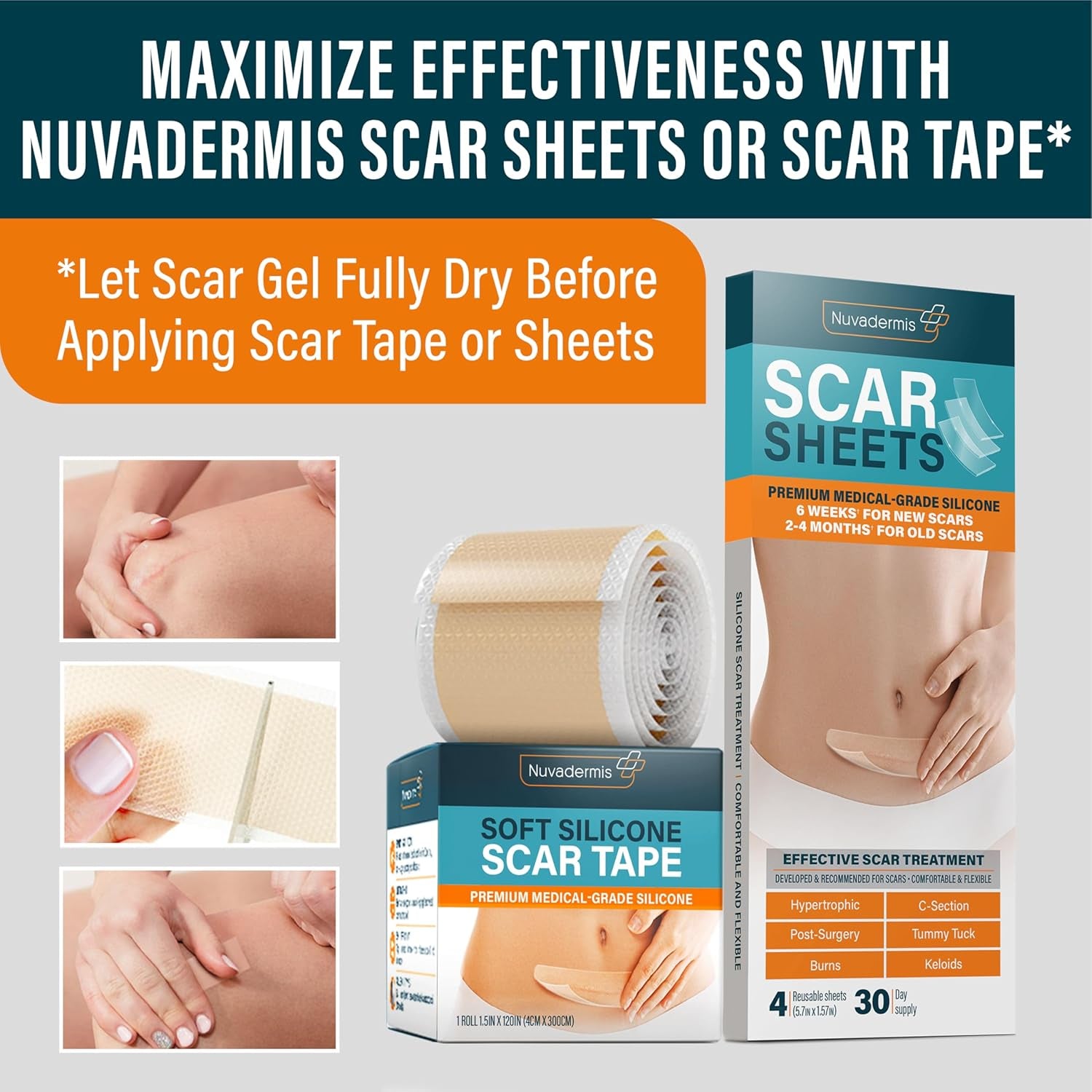 Overnight Intensive Scar Cream with Retinol, Allantoin, Vitamin E, Betaine – 1.35 Fl Oz PM Scar Cream Treatment for C-Sections, Keloids & Post-Surgery Care