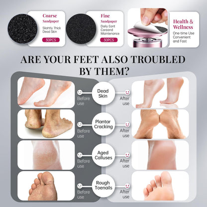 Aluminum File Grinder Adjustable Pedicure Tools with 60pcs Sandpaper