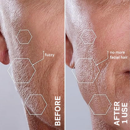 Beauty Sonicsmooth Pro+ Dermaplane Razor for Women Face + Eyebrow Trimmer Dermaplaning System W/Led Light Peach Fuzz Remover -16 Dermaplaning Blades & 2 Microsmooth Exfoliation Tips