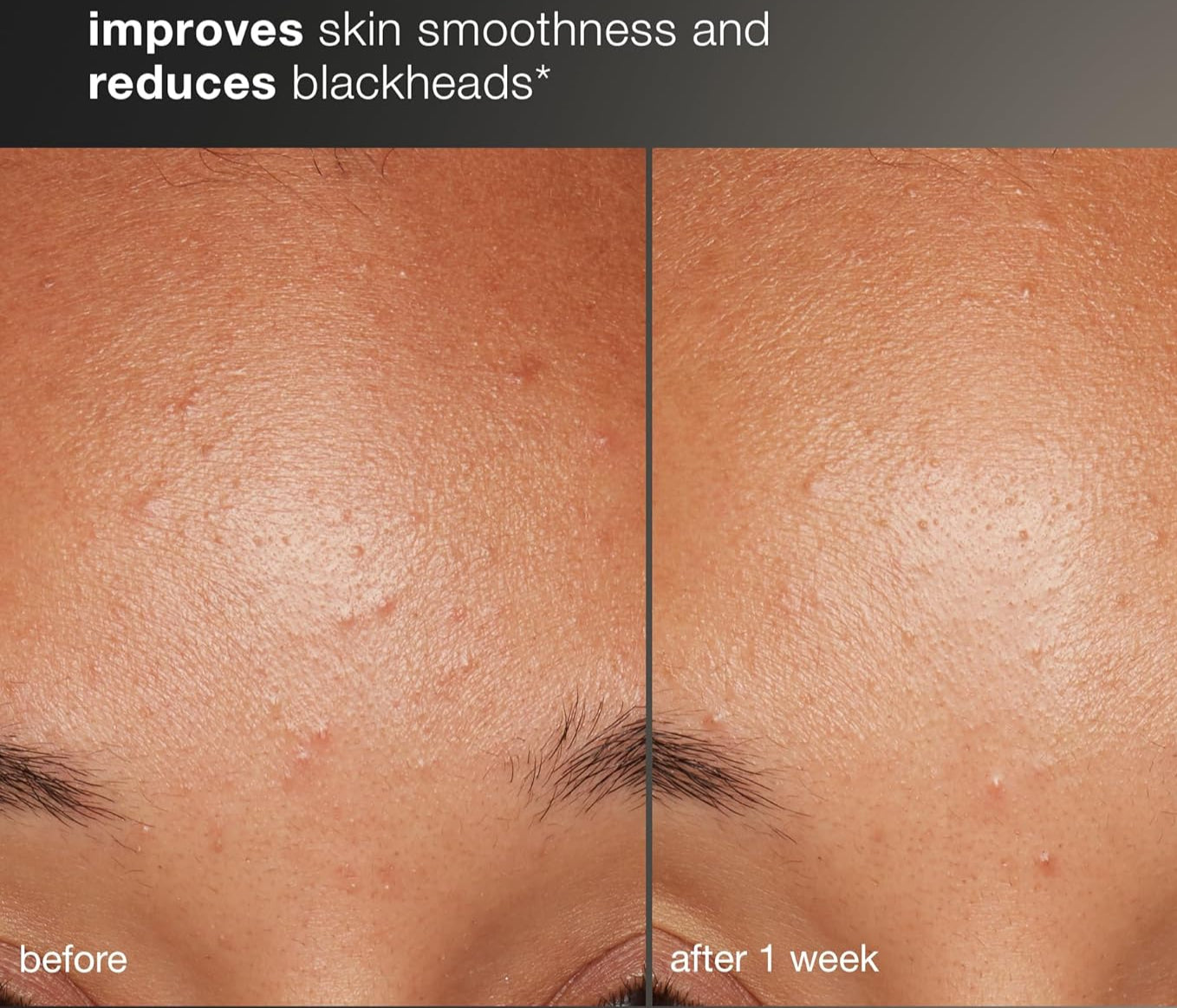 Dermalogica Healthy Skin Kit