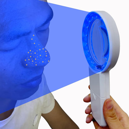 Cordless Wood'S Lamp Ringworm Detection Light-Skin Testing-Esthetician-Veterinaria-5X Magnifying Wood Lamp Black Light-16 Led-Battery Powered