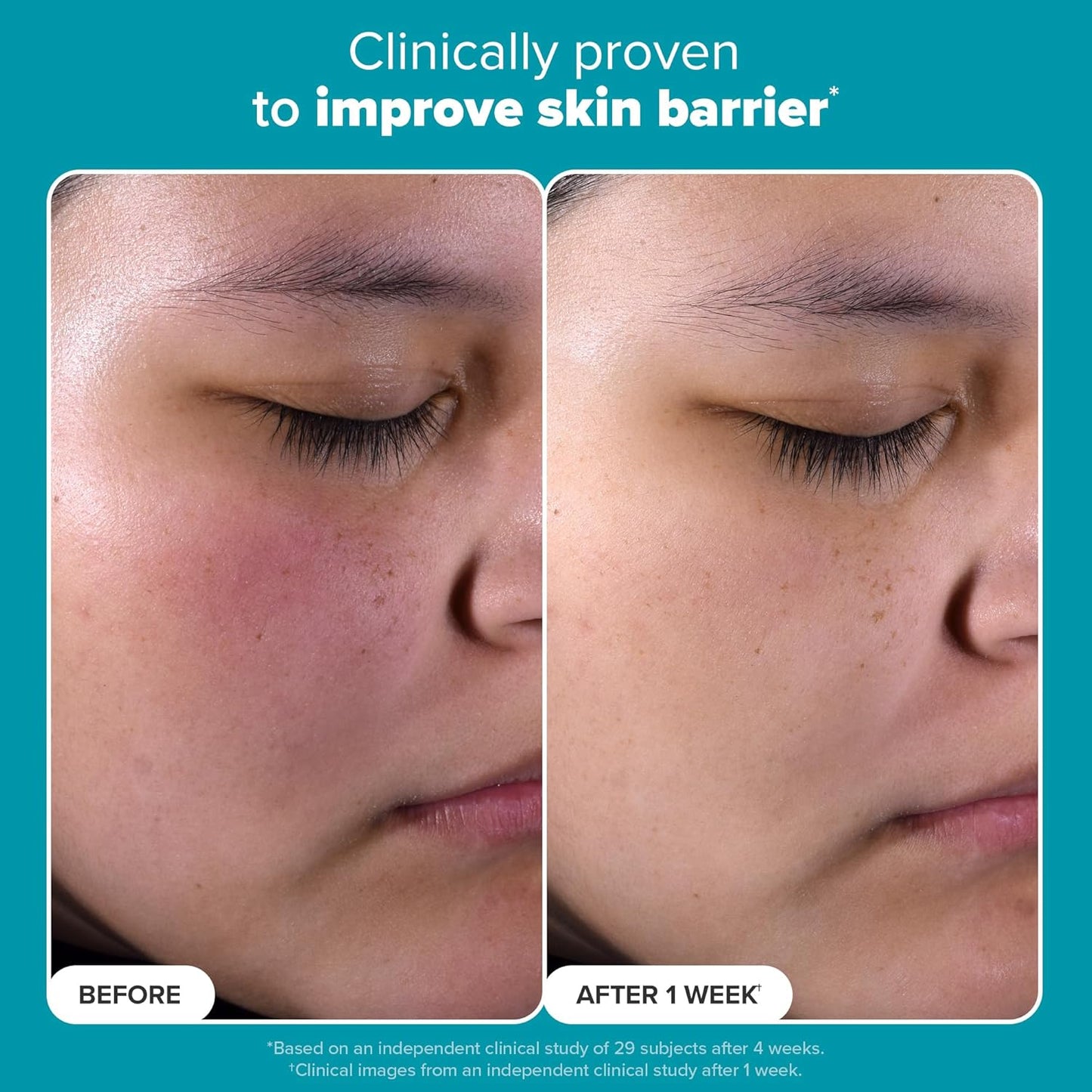 SKIN PERFECTING 2% BHA Liquid Exfoliant with Salicylic Acid, Facial Polish for Enlarged Pores, Wrinkles & Fine Lines, Suitable for Blackhead-Prone Skin, Fragrance-Free