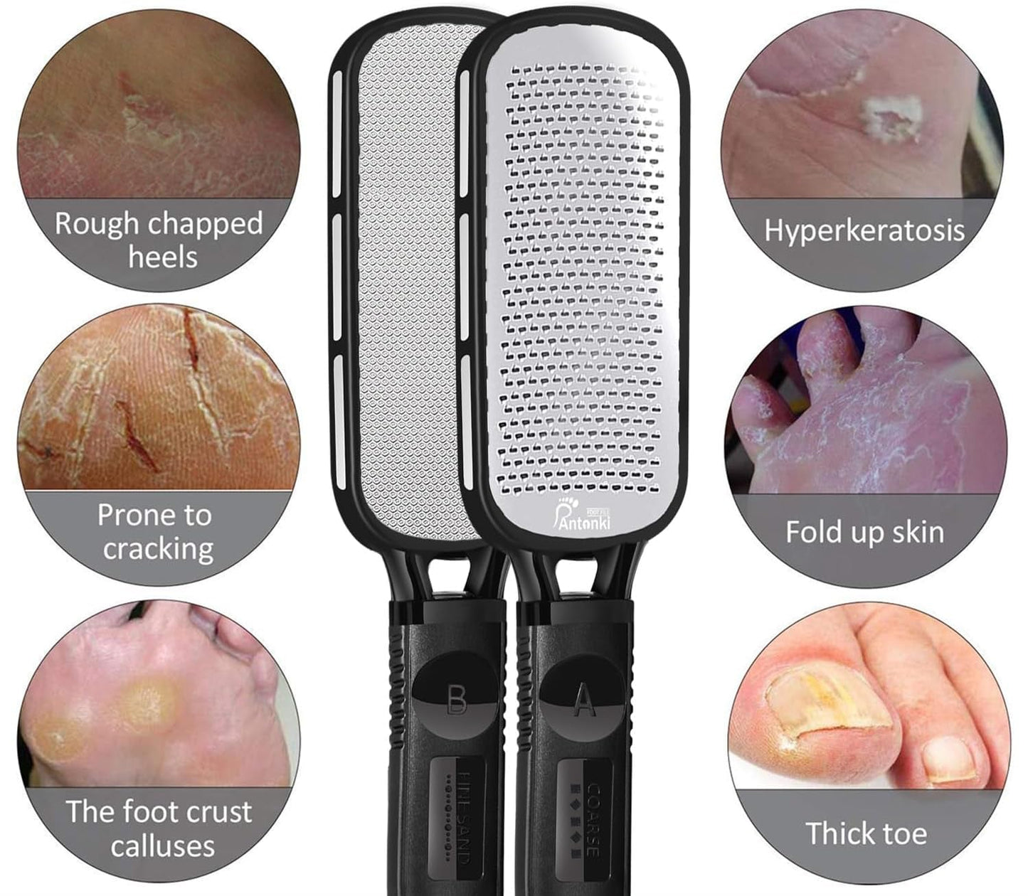 Stainless Steel Professional Foot File and Callus Remover for Effective Dead Skin, Cracked Heel, and Corn Treatment