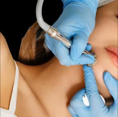MICRODERMABRASION