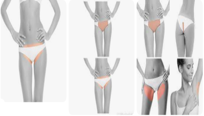 LASER ELITES- BODY II