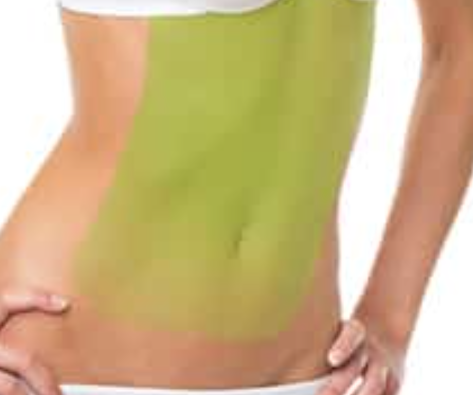 LASER ELITES - BODY I