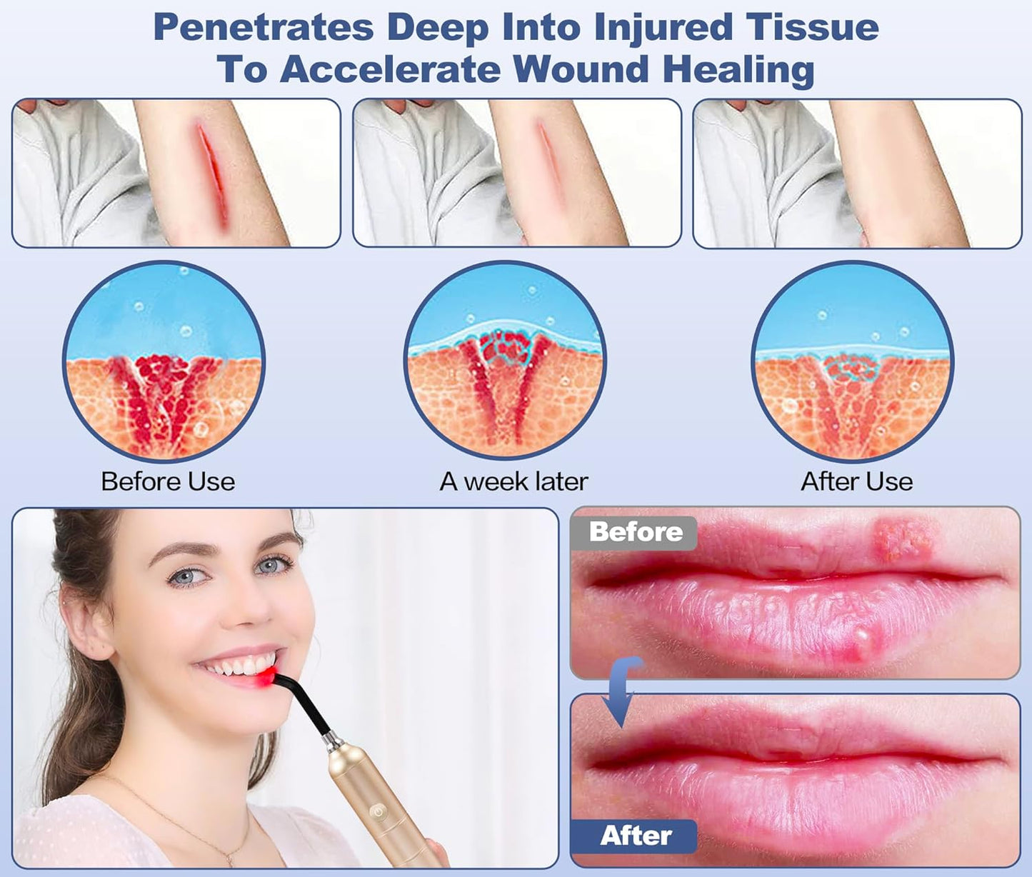 Infrared Red Light Therapy Device for Joints & Muscles Pain Relief, 660:660:810:850:940Nm Cold Sore Canker Fever Treat, Portable near Infrared Wand for Face & Body Mouth Nose Effective 2 in 1 Modes