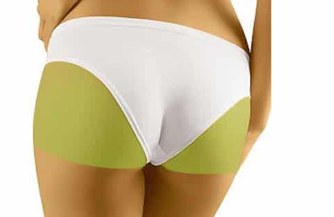 LASER ELITES- BODY II