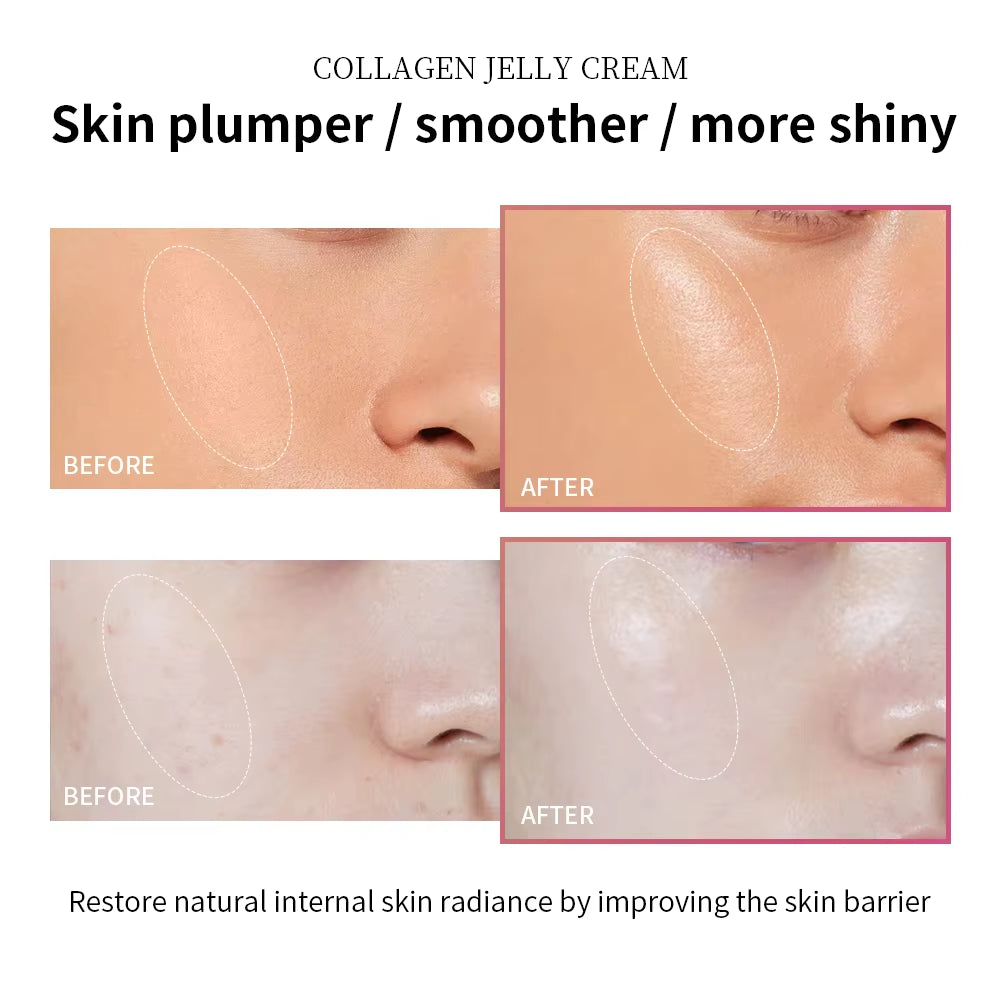 Moisturizing Collagen Jelly Cream Niacinamide Hydrolyzed Hydration Skincare