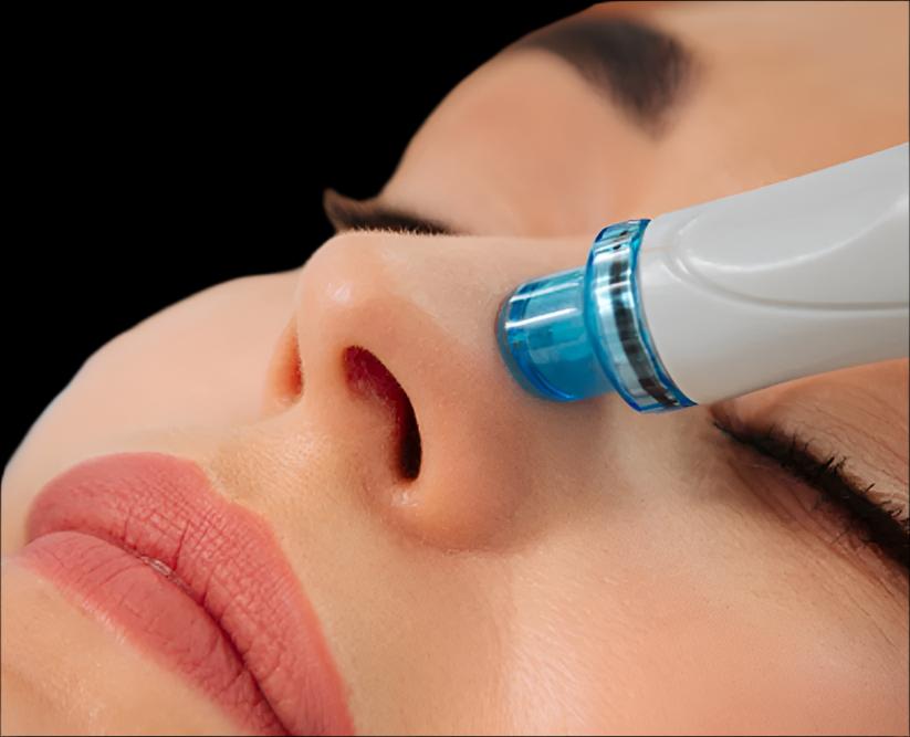 HYDRO FACIAL