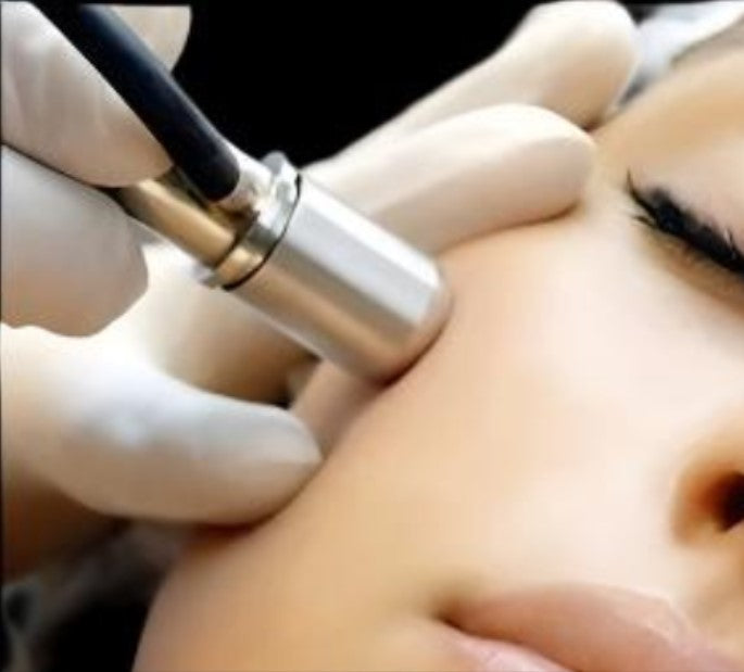 MICRODERMABRASION